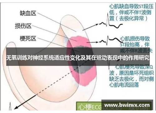 无氧训练对神经系统适应性变化及其在运动表现中的作用研究